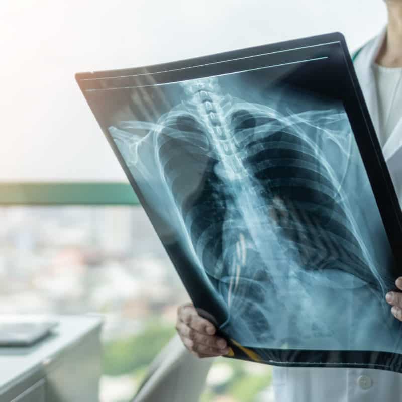 X-ray, Computerized Tomograpy or CT Scans, and Ultrasound can all help diagnose injury or illness. All of these tests are available at Ally Medical Emergency Room