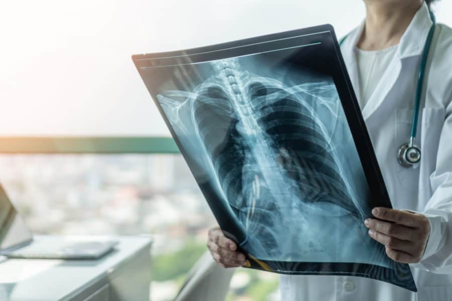 X-ray, Computerized Tomograpy or CT Scans, and Ultrasound can all help diagnose injury or illness. All of these tests are available at Ally Medical Emergency Room