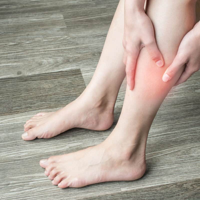 A deep vein thrombosis is a blood clot in the arm or leg.