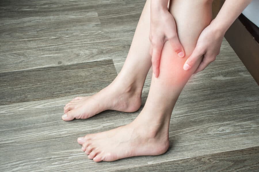 A deep vein thrombosis is a blood clot in the arm or leg.